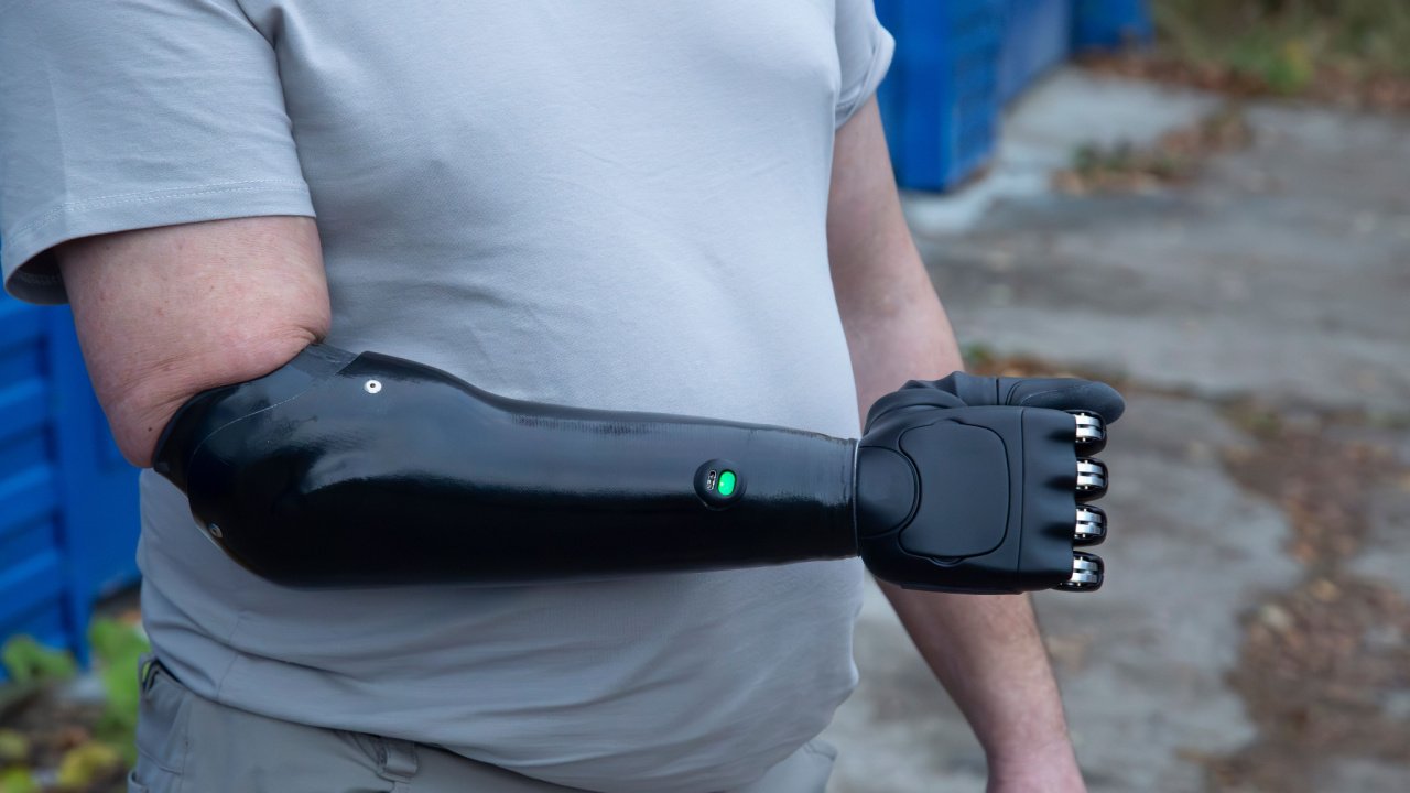 Bus kompensuojami itin modernūs protezai