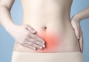 Endometriozė – mitais apipinta liga