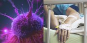 Šie 4 ženklai išduoda klastingą vėžį: nenumokite į juos ranka