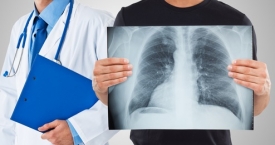 Plaučių ligų diagnostikai ir gydymui Santariškių klinikų medikai pasitelkė šaltį