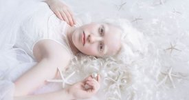 Albinizmu sergančių žmonių grožis fotografės darbuose (foto)