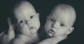 Prieš 11 metų atskirtos Siamo dvynės džiaugiasi visaverčiu gyvenimu (video)