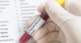 Cholesterolio „baubas“: ar reikia bijoti?