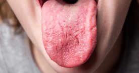 Kodėl sutrūkinėja liežuvis ir kokias pasekmes tai gali sukelti?