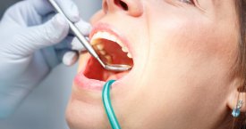 Odontologės patarimai, kaip elgtis prasidėjus dantų problemoms