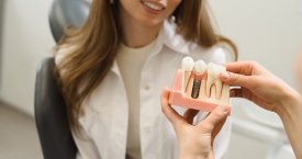 Paaiškino, kuo dantų implantai pranašesni už įdedamus protezus: svarbu nedelsti