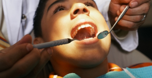Mitai apie dantų ėduonį (II dalis)