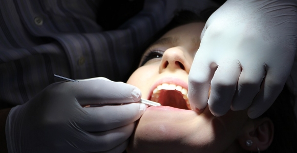 Odontologė išdavė tikrąją holivudinės šypsenos paslaptį