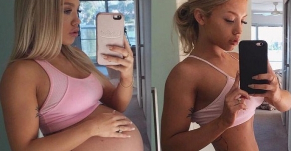 Merginos nuotraukos prieš ir po gimdymo sulaukė smerkiančių komentarų (foto)