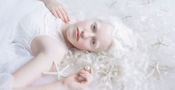 Albinizmu sergančių žmonių grožis fotografės darbuose (foto)