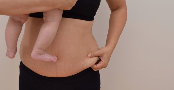 Specialistai pataria: kaip atgauti formą po gimdymo?