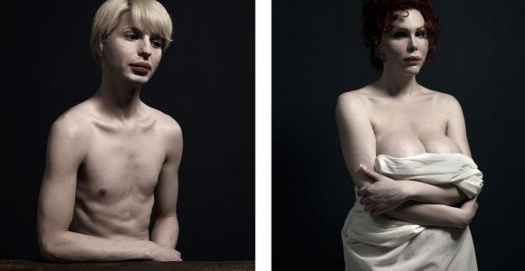 Šokiruojantis fotoprojektas: žmonės, negalintys gyventi be plastinės chirurgijos (foto)