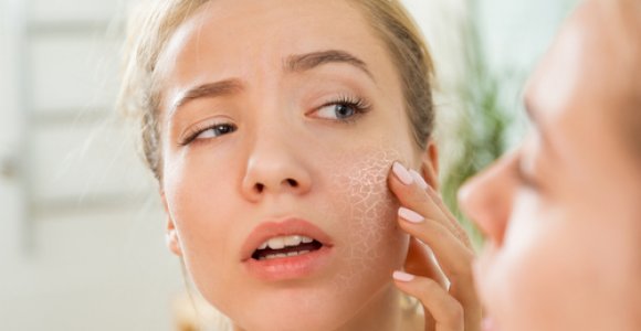 Dermatologė įspėja: sausas oras patalpose – sparčiai pradėjusios senti odos priežastis