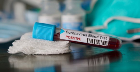 Antradienį patvirtinti trys nauji koronaviruso infekcijos atvejai Lietuvoje