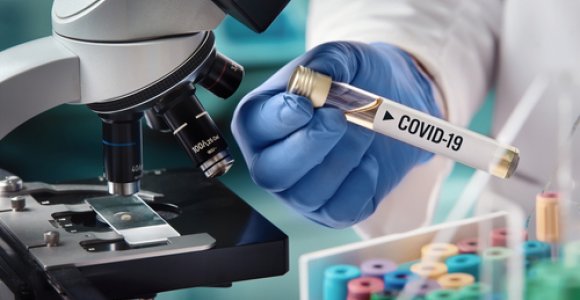 Patvirtinti dar 24 koronaviruso atvejai
