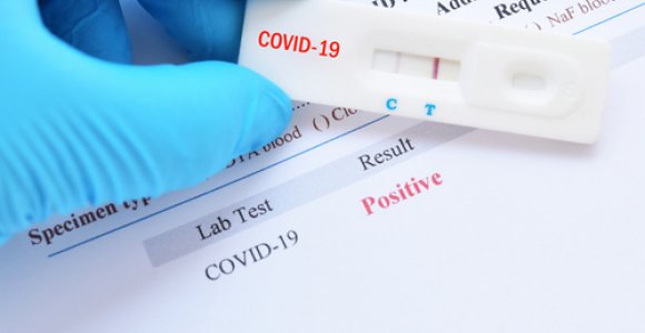 Lietuvoje registruota 11 naujų koronaviruso atvejų