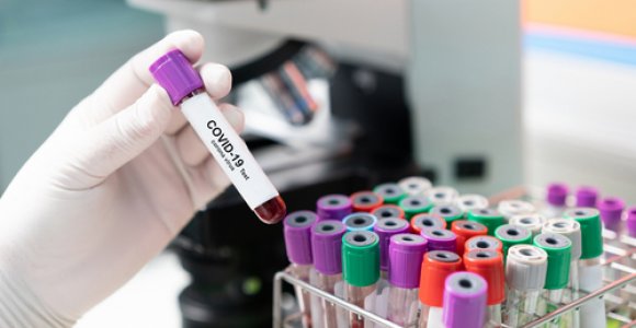 Lietuvoje patvirtinti nauji 766 koronaviruso atvejai