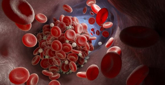 Gydytojų patarimai: kaip išlaikyti kraujo krešėjimo pusiausvyrą