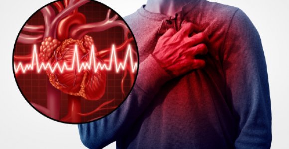 Tylieji infarkto požymiai: štai kaip atpažinti laiku