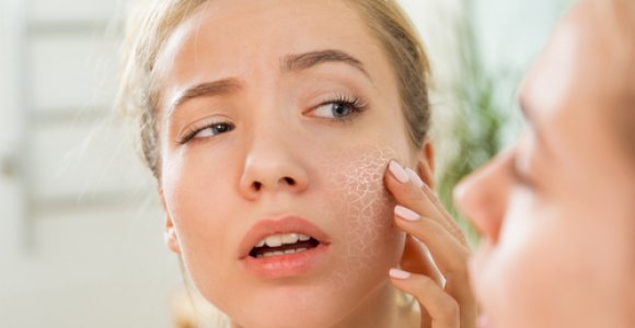 Skelbia šildymo sezono startą: apsaugokite odą nuo išsausėjimo