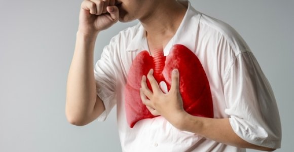 Klastinga tuberkuliozė: kas tai ir kokios prevencinės priemonės?