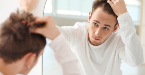 Plaukų slinkimas vyrams: kas jį sukelia ir kaip spręsti šią problemą?