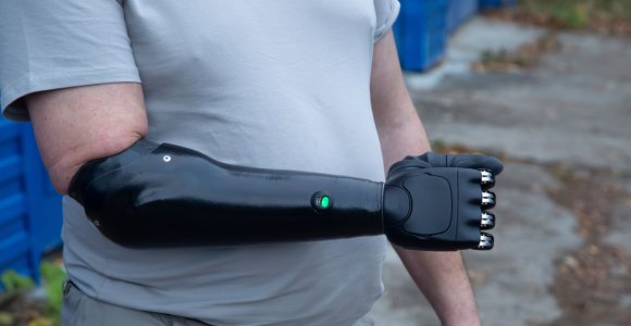 Bus kompensuojami itin modernūs protezai