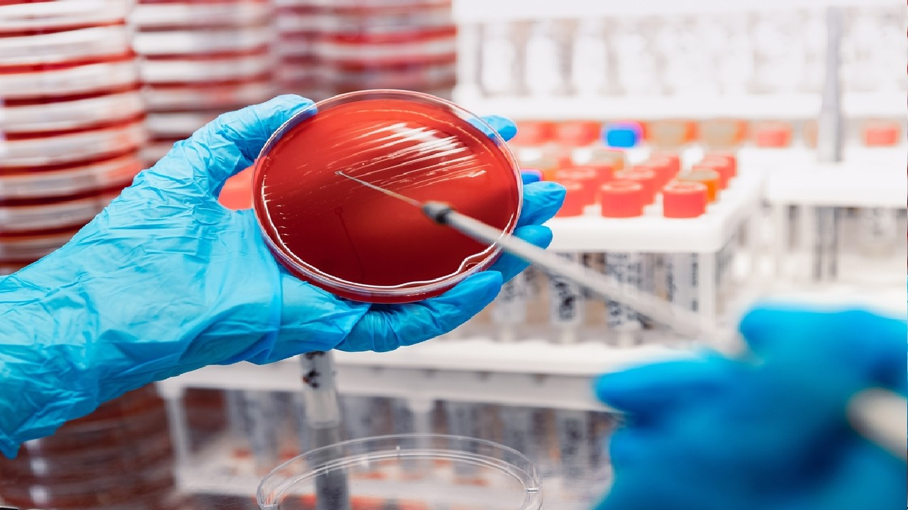 Sepsis – gyvybei pavojinga infekcinė organizmo reakcija.