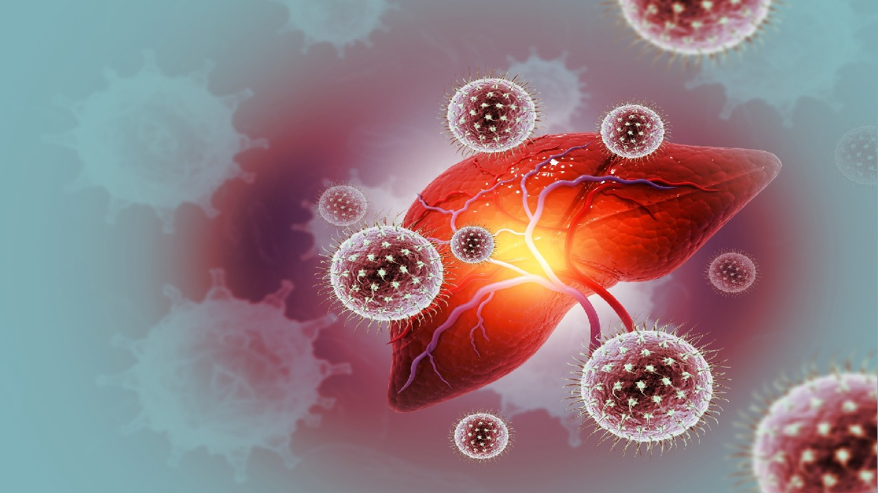 Hepatitas C – virusinė kepenų liga. 