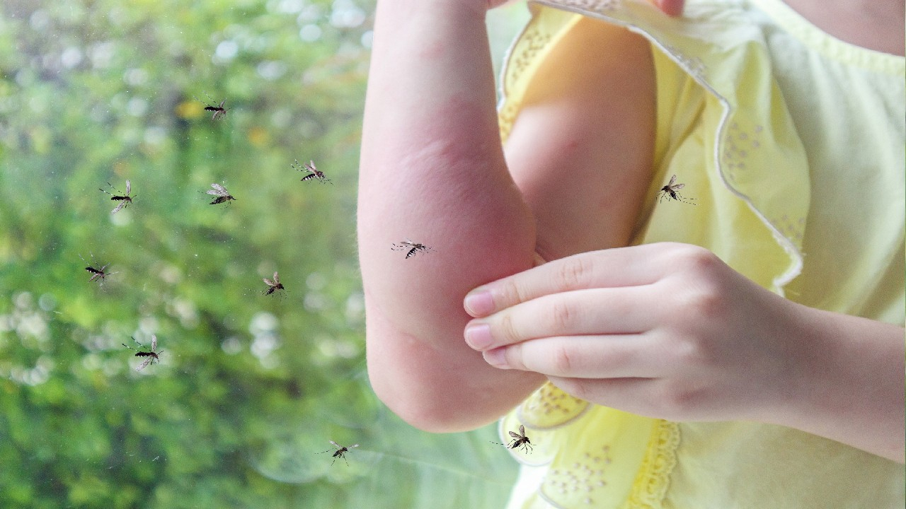 Alergija uodams – odos reakcija į uodų įgėlimus.