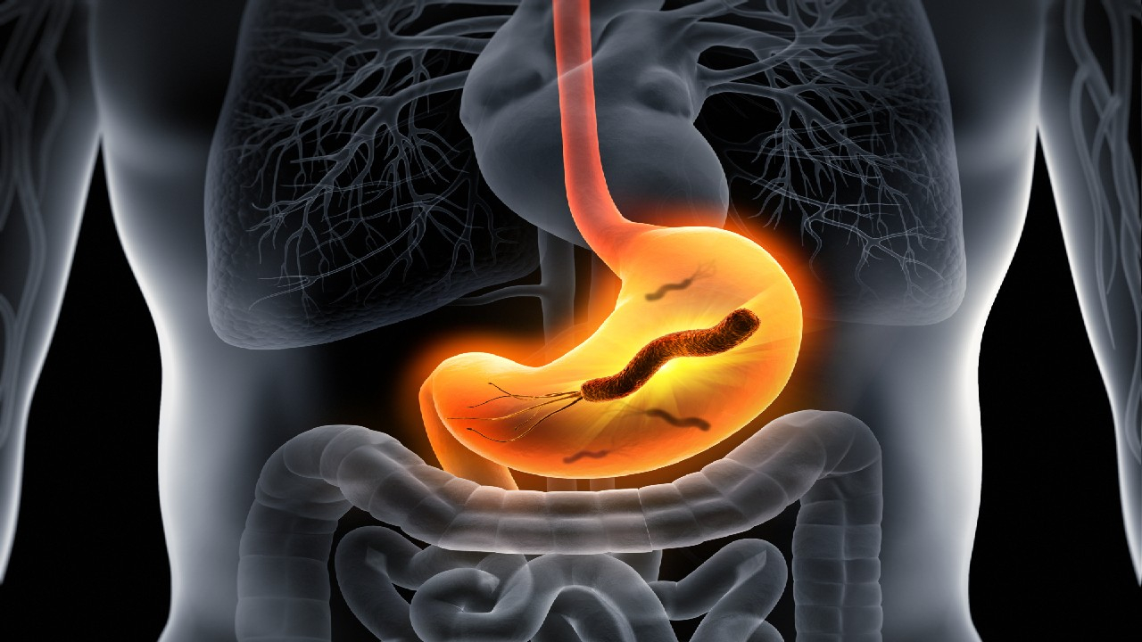 Helicobacter pylori – tai bakterija, pažeidžianti skrandžio gleivinę ir galinti sukelti gastritą, opaligę ar padidinti skrandžio vėžio riziką.