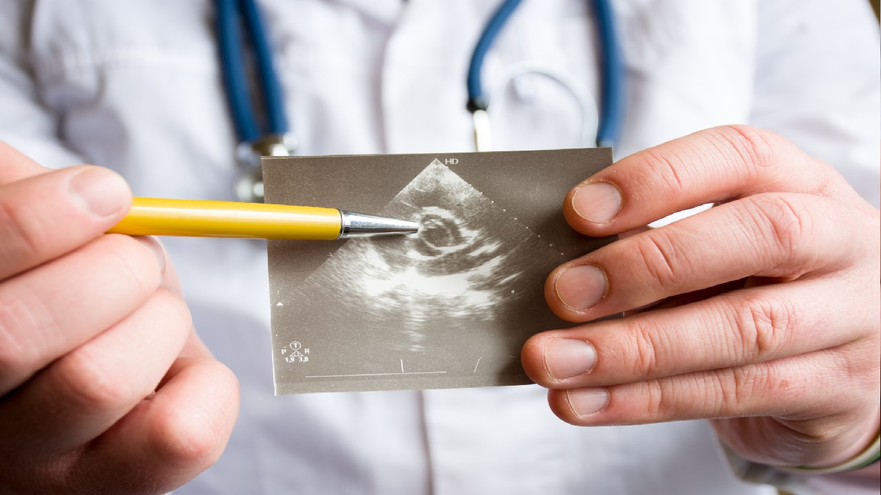 Mitralinio vožtuvo nepakankamumas – tai širdies vožtuvo sutrikimas, kai kraujas teka atgal į prieširdį, silpnindamas širdies veiklą ir kraujotaką. 