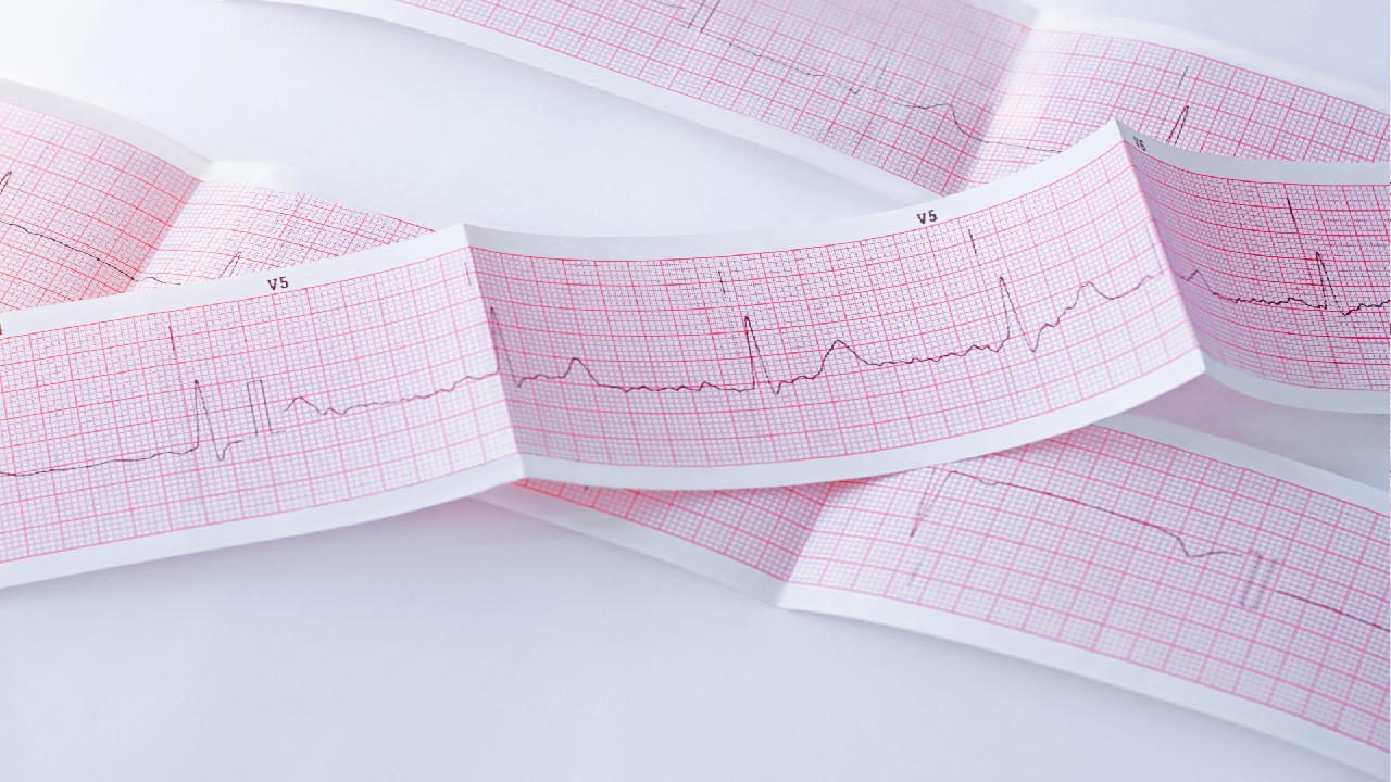 Mitralinio vožtuvo prolapsas – tai širdies vožtuvo būklė, kai vožtuvo burės išsigaubia į kairįjį prieširdį, sutrikdydamos normalų kraujo tekėjimą.