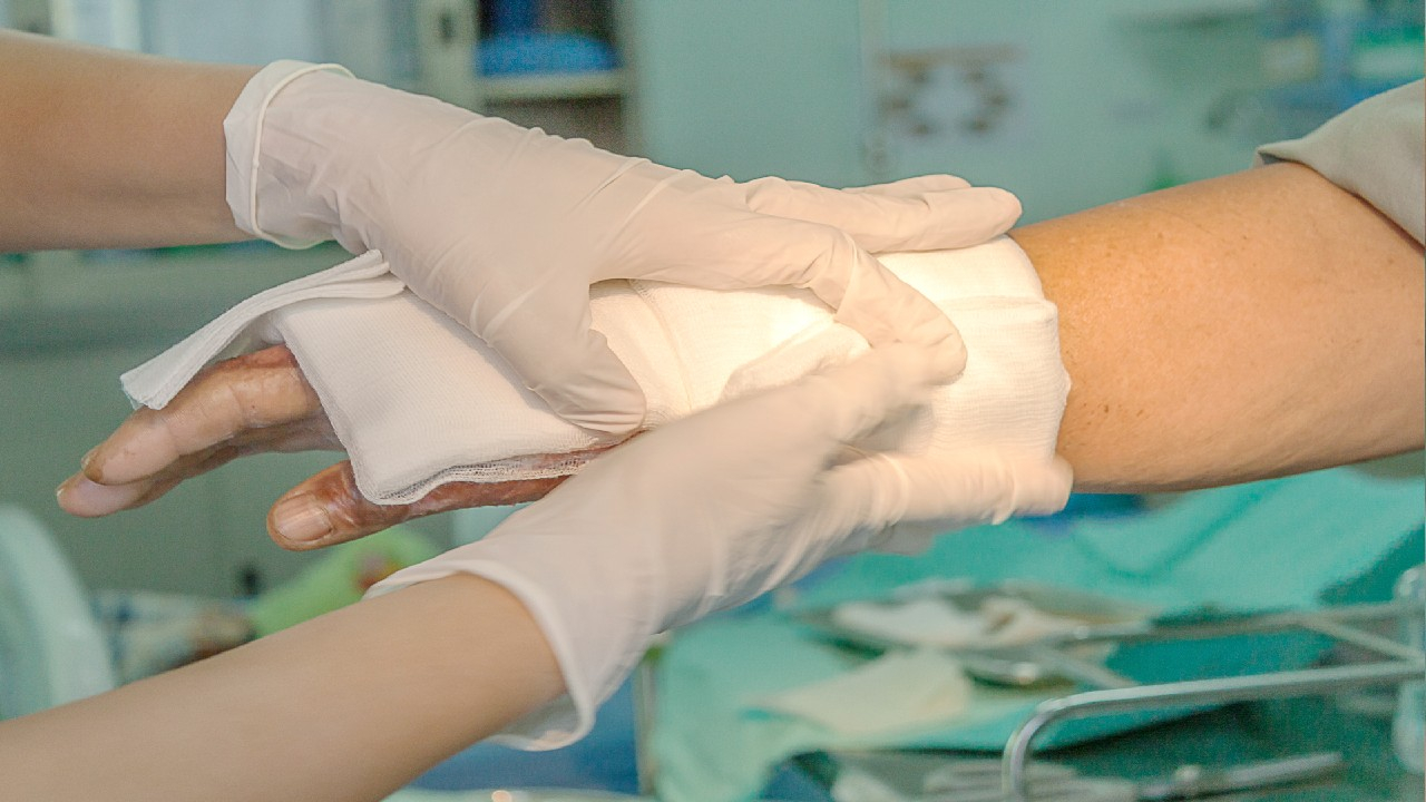Nudegimas ugnimi – tai audinių pažeidimas, atsirandantis dėl tiesioginio liepsnos ar karščio poveikio odai ir gilesniems sluoksniams.