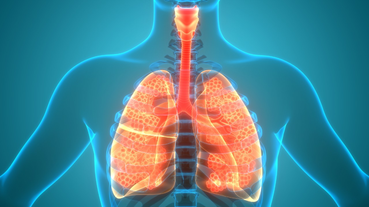 Pneumonija – tai infekcinis plaučių audinio uždegimas, kuriam būdingas alveolių užpildymas skysčiu ir sutrikusi dujų apykaita.